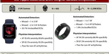 UK Clinical Study Finds Sky Labs’ Smart Ring ‘CART-I’ More Sensitive Than Apple Watch for AFib Detection