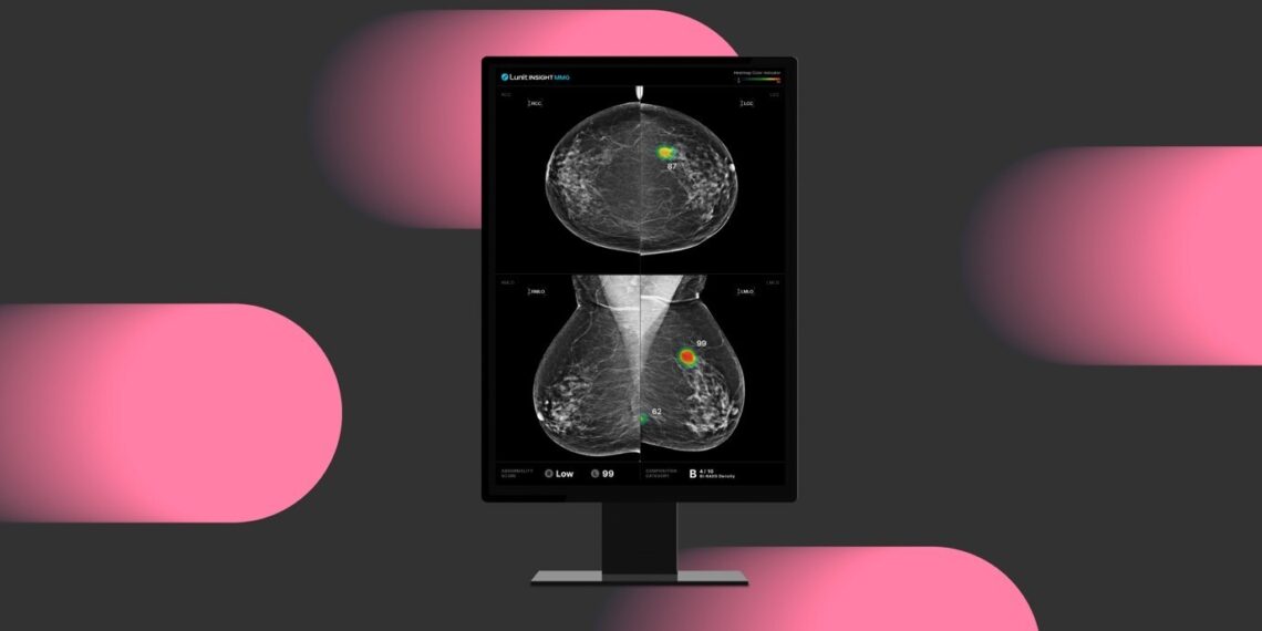 Lunit Study in Radiology Highlights Trust Gap Between Radiologists and AI in Breast Cancer Screening