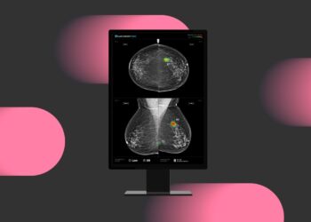 Lunit Study in Radiology Highlights Trust Gap Between Radiologists and AI in Breast Cancer Screening