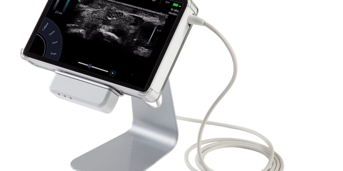 Natus announces integration of InVisus Pro NMUS into Natus Elite software