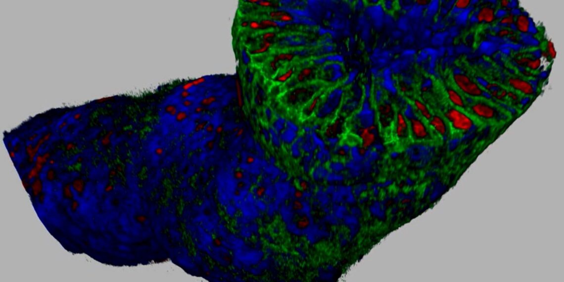Greater Precision of HER2-Expressing Breast Cancer Treatment with 3D Pathology: New JelloX Research Collaboration