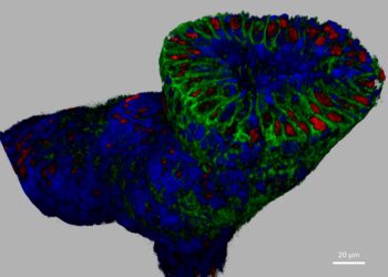 Greater Precision of HER2-Expressing Breast Cancer Treatment with 3D Pathology: New JelloX Research Collaboration