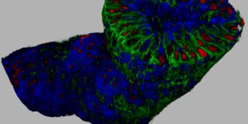 Greater Precision of HER2-Expressing Breast Cancer Treatment with 3D Pathology: New JelloX Research Collaboration