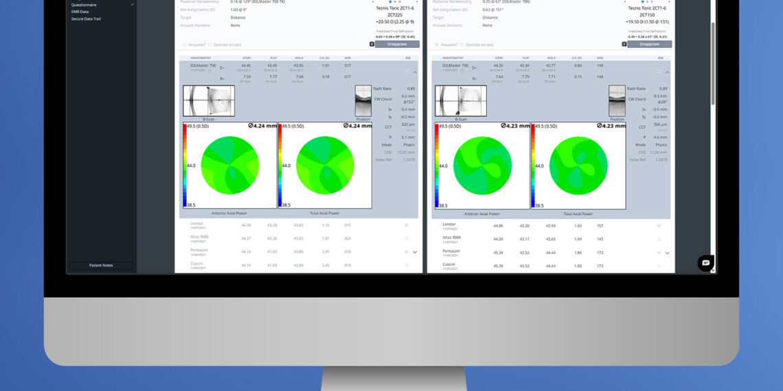 ZEISS continues to drive digital era forward in ophthalmology; celebrates 2 million digitally-planned cataract cases in the U.S. alone