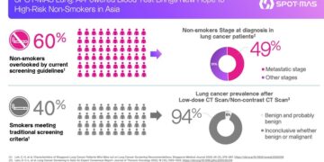 SPOT-MAS Lung: AI-Powered Blood Test Brings New Hope to High-Risk Non-Smokers in Asia