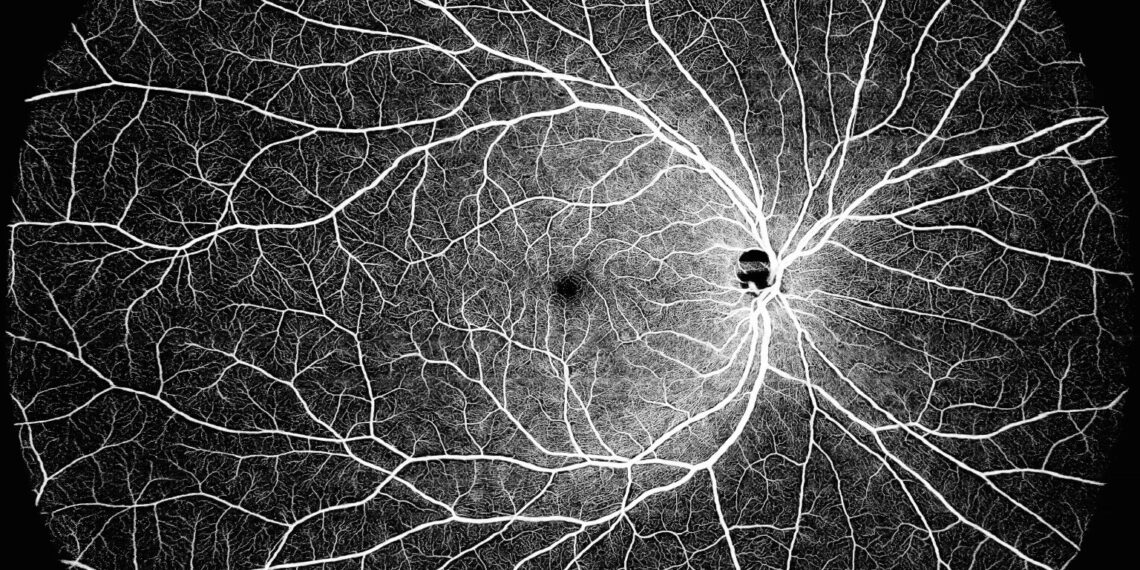 Intalight™ Receives CE Mark for Its Progressive DREAM OCT™ Swept Source Imaging