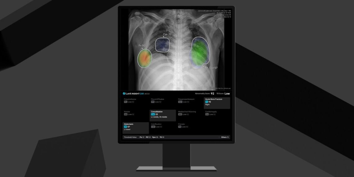 Lunit Launches Enhanced Lunit INSIGHT CXR4, Secures CE MDR Certification for Expanded AI Capabilities