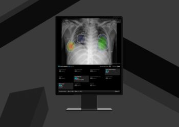 Lunit Launches Enhanced Lunit INSIGHT CXR4, Secures CE MDR Certification for Expanded AI Capabilities