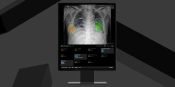 Lunit Launches Enhanced Lunit INSIGHT CXR4, Secures CE MDR Certification for Expanded AI Capabilities