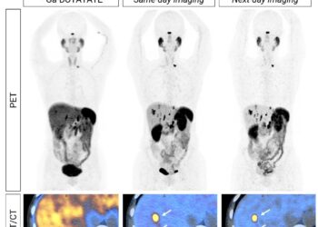 DISCO topline results: 64Cu-SARTATE is highly effective in detecting tumours in NET patients compared to SOC imaging. Phase III planning underway.