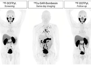 SABRE topline results: Cu-64 SAR-Bombesin is effective in detecting prostate cancer recurrence in patients with negative SOC imaging