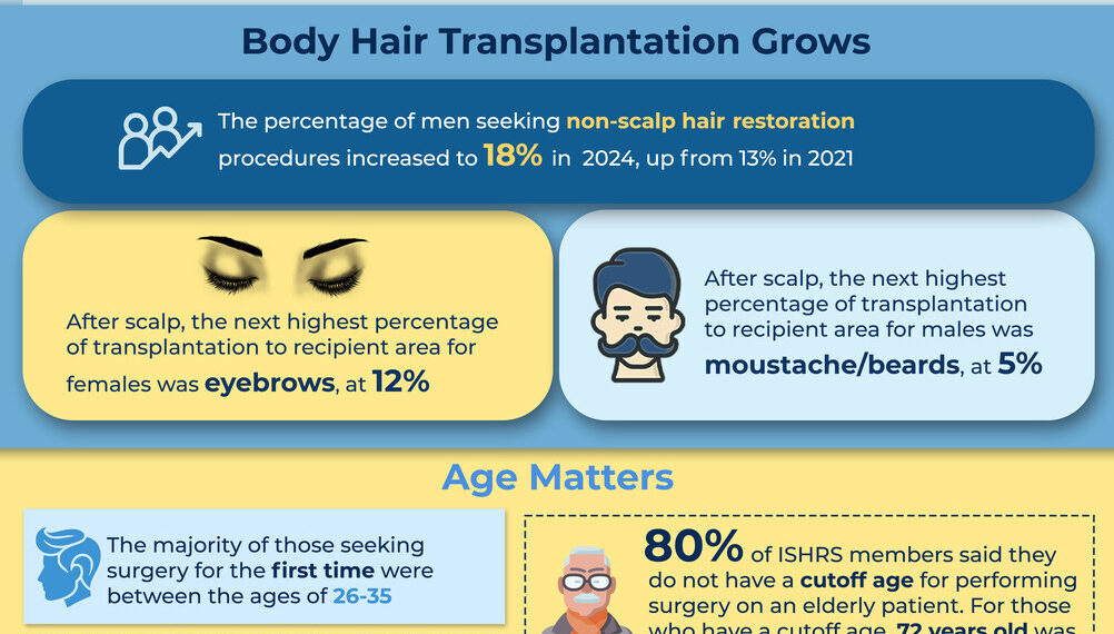 New Survey Finds Younger Adults, More Women Seeking Treatment for Hair Loss