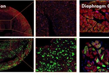 METiS Technologies Showcases AI-Powered Nanodelivery Platform at the 2025 Controlled Release Society Annual Meeting