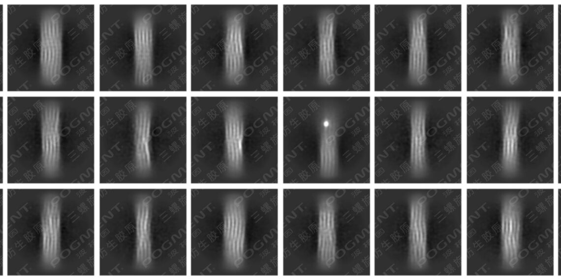 GLOBAL FIRST “High-Definition Image”: Decoding the “Code of Youth” – LivingPhoenix’s POGMENT Collagen Breakthrough Fills Global Gap