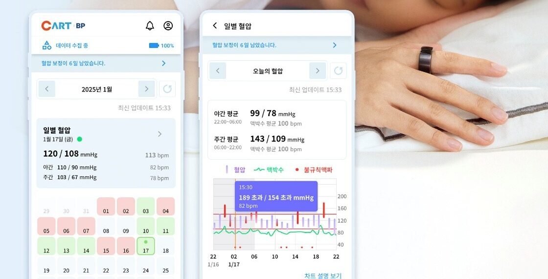 Sky Labs Launches CART BP, a Ring-Type Cuffless Blood Pressure Monitor