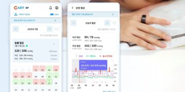Sky Labs Launches CART BP, a Ring-Type Cuffless Blood Pressure Monitor