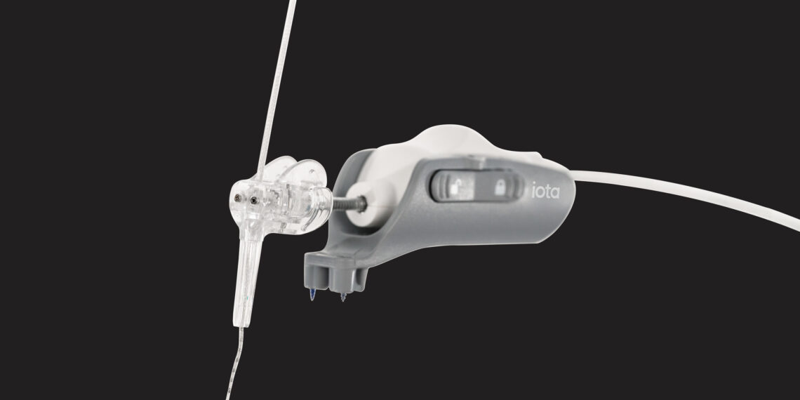 iotaMotion Surpasses 1,000 Clinical Procedures Performed with iotaSOFT® –Defining a New Era in Cochlear Implant Surgery