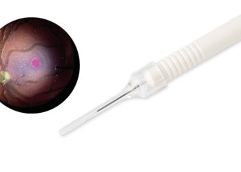 ZEISS expands DORC portfolio and further strengthens digital footprint with improved workflow efficiency and digital visualization