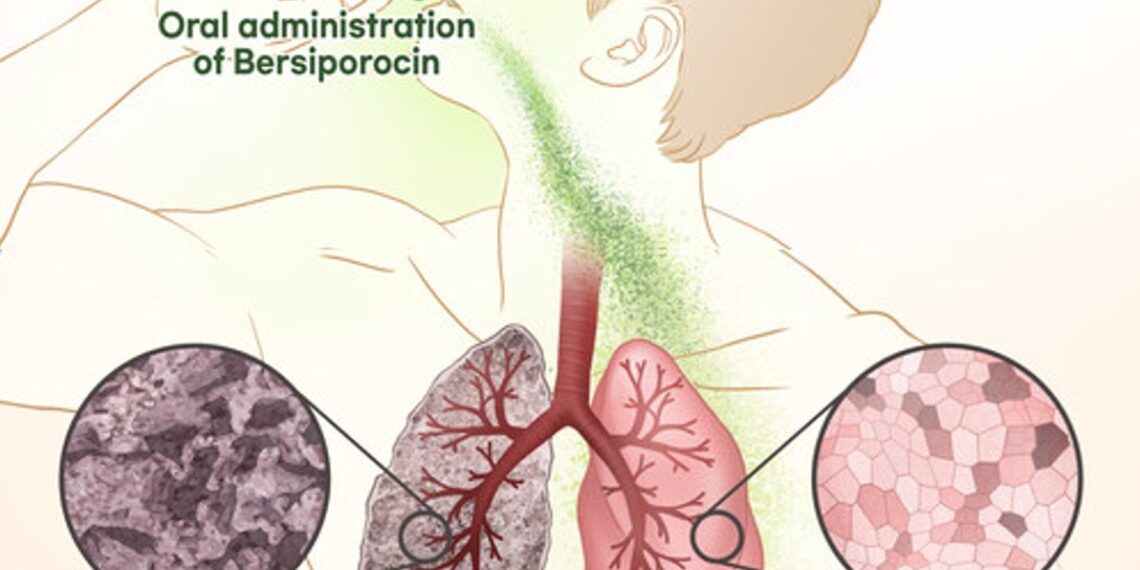 Daewoong Pharmaceutical: Third IDMC Reaffirms Safety of Bersiporocin and Recommends Continuation of Global Phase 2 Clinical Trial