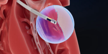 Field Medical First-in-Human 6-Month Data Selected for Late-Breaking Clinical Trial at VT Symposium 2025