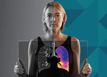 4DMedical Secures US$100+ Million Funding to Accelerate U.S. Expansion and increase Technology Dominance in Software-Based Lung Imaging