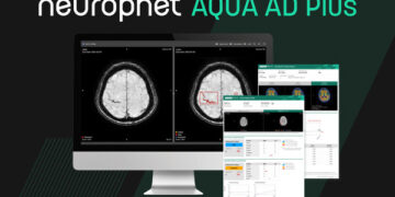 Neurophet Secures FDA 510(k) Clearance for “Neurophet AQUA AD Plus,” Marking Its Third U.S. Regulatory Milestone