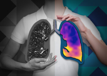 4DMedical receives CE Mark for CT:VQ™, enabling commercial launch across the European Union