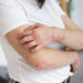 Why Chronic Eczema Can Last for Decades, and What a Recent Case Is Revealing