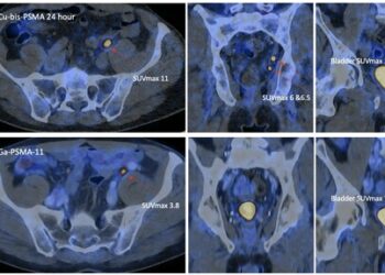 Co-PSMA data presented at EAU Annual Congress 2026 with manuscript accepted for publication in the European Urology journal