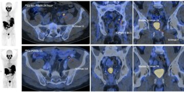 Co-PSMA data presented at EAU Annual Congress 2026 with manuscript accepted for publication in the European Urology journal