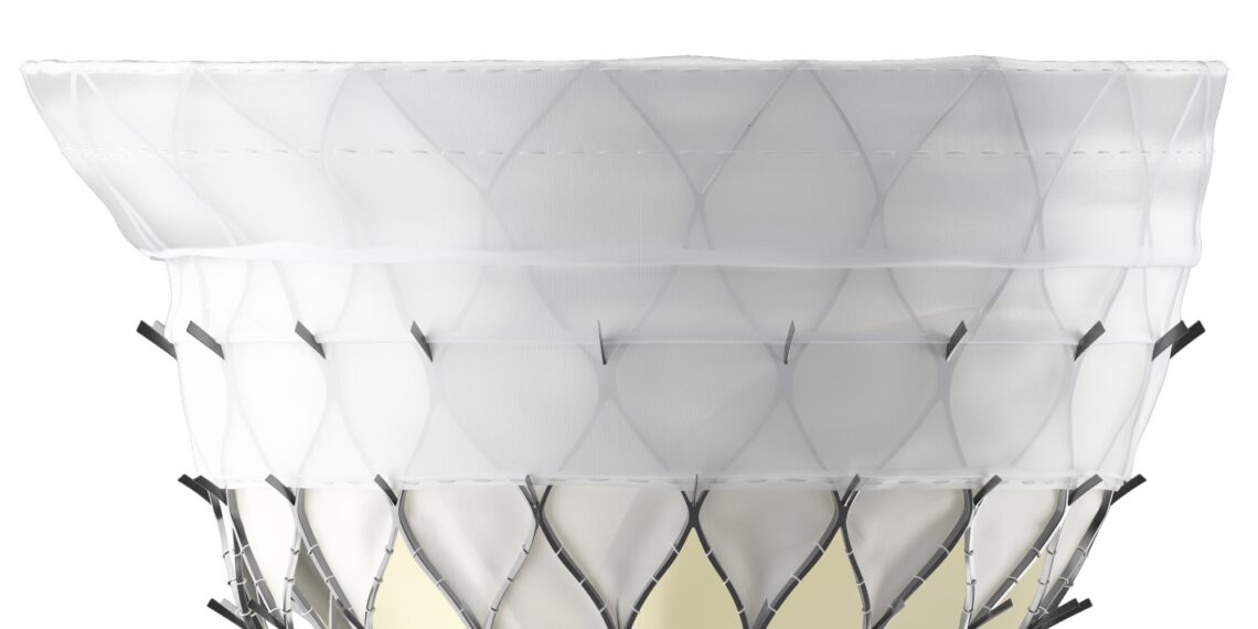 First Implant of KingstronBio’s ProStyle M® Transcatheter Mitral Valve System Successfully Completed in National Multicenter Confirmatory Study