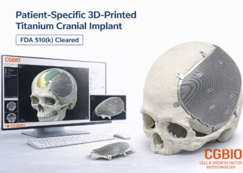 CGBIO Receives FDA 510(k) Clearance for Patient-Specific Titanium Implant ‘EASYMADE TI’