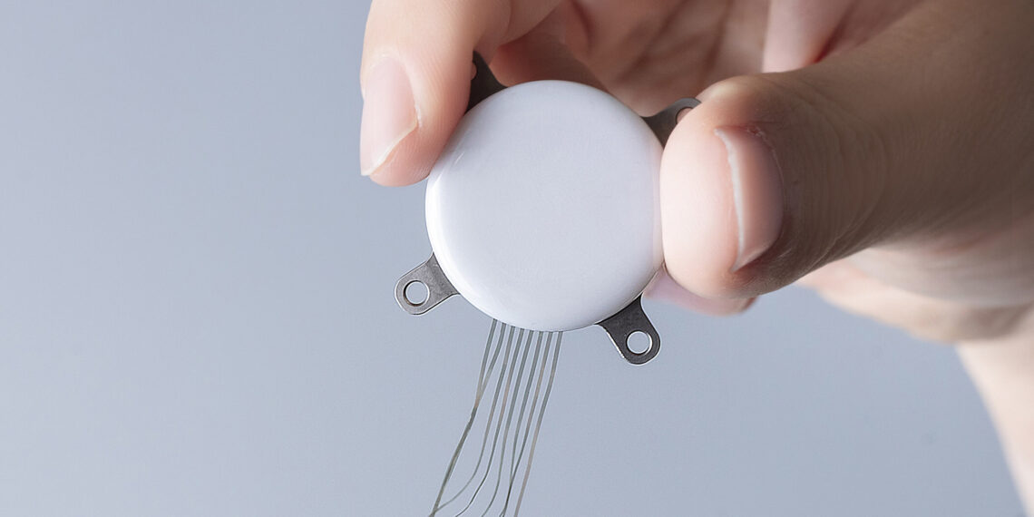 StairMed Secures RMB 500 Million Financing Led by Alibaba, Joined by Tencent