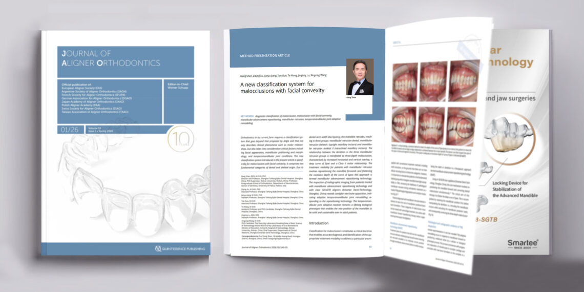 New Classification System of Malocclusions Published in the Journal of Aligner Orthodontics (JAO) by Prof. Gang Shen’s Team