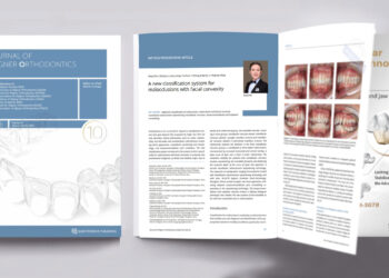 New Classification System of Malocclusions Published in the Journal of Aligner Orthodontics (JAO) by Prof. Gang Shen’s Team