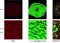 METiS TechBio to Present Late-Breaking Data on Near-Complete Cardiomyocyte Delivery at CRS 2026
