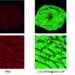 METiS TechBio to Present Late-Breaking Data on Near-Complete Cardiomyocyte Delivery at CRS 2026