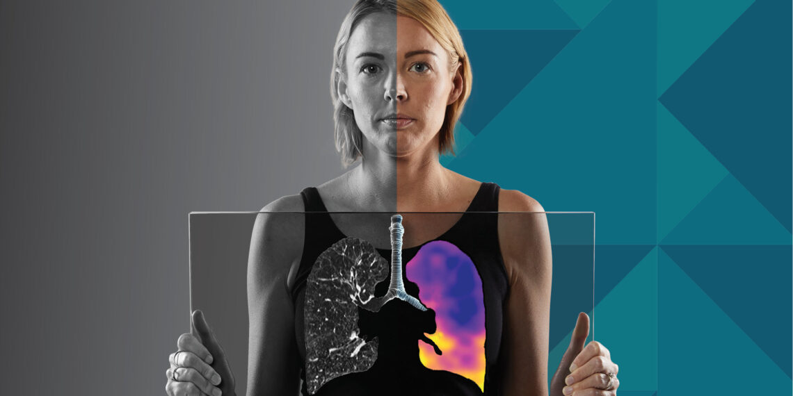 4DMedical Receives TGA Approval for CT:VQ™, Bringing Non-Contrast Ventilation-Perfusion Imaging to Australia