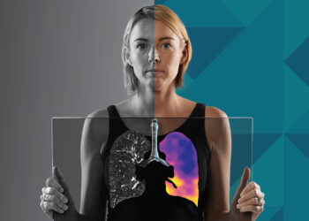 4DMedical Receives TGA Approval for CT:VQ™, Bringing Non-Contrast Ventilation-Perfusion Imaging to Australia
