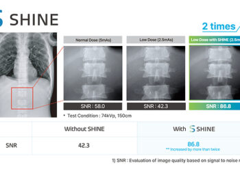 Rayence Launches ‘SHINE,’ a Next-Generation X-ray Image Processing Technology for Low Dose Imaging