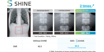 Rayence Launches ‘SHINE,’ a Next-Generation X-ray Image Processing Technology for Low Dose Imaging