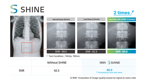 Rayence Launches ‘SHINE,’ a Next-Generation X-ray Image Processing Technology for Low Dose Imaging