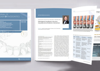 Professor Gang Shen’s Orthodontic Team Publishes Third Consecutive Paper in the Journal of Aligner Orthodontics