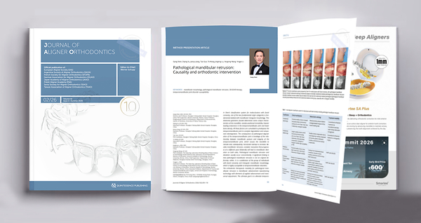 Professor Gang Shen’s Orthodontic Team Publishes Third Consecutive Paper in the Journal of Aligner Orthodontics
