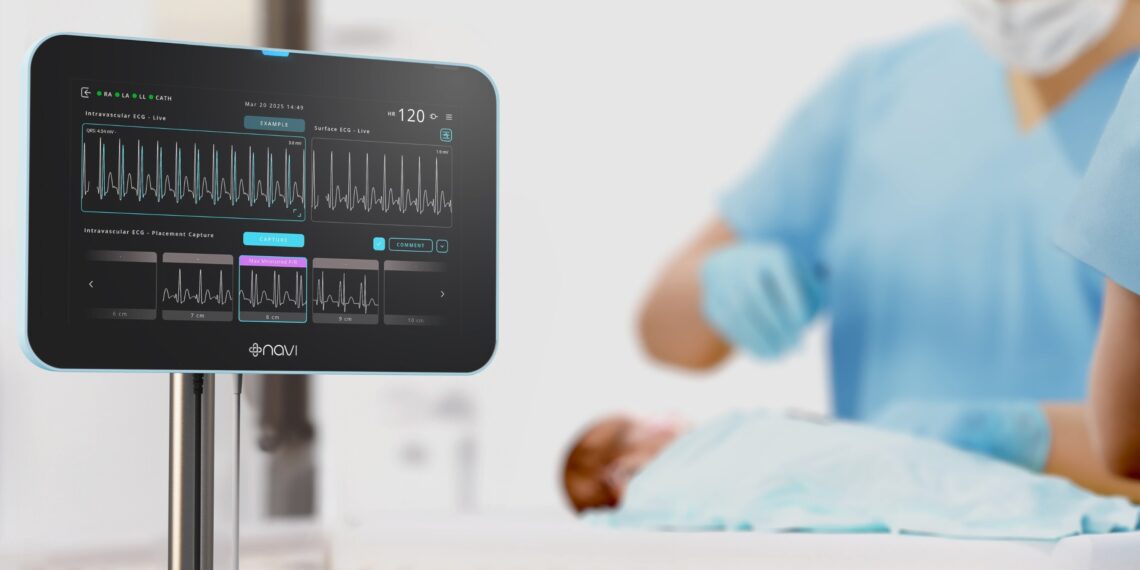 Australian medtech Navi raises $A6.8 million to commercialise breakthrough paediatric technology in the US