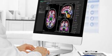 Neurophet Supplies ‘Neurophet AQUA’ to Raffles Medical in Singapore