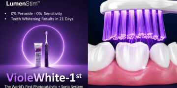 LumenStim Prepares to Launch Next-Generation Teeth Whitening System on Kickstarter