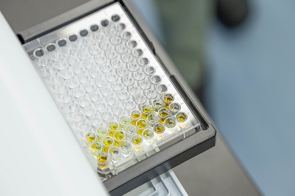 Taiwanese Team Highlights Precision Indoxyl Sulfate Testing for Early CKD Management in Japan