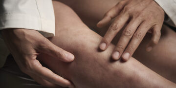 LANDMARK GLOBAL STUDY REVEALS CRITICAL INEQUITIES IN ACCESS TO DERMATOLOGICAL CARE