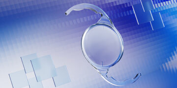 ZEISS announces commercial availability of bitoric hydrophobic monofocal IOL – the ZEISS AT LUCIA toric 721P